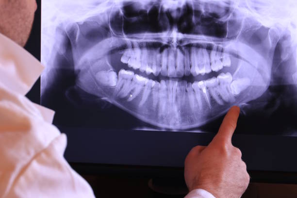 Best Emergency Treatment for Toothache in Parkersburg, WV