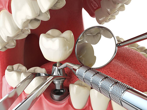 Best Emergency Dental Care for Trauma or Injury in Parkersburg, WV
