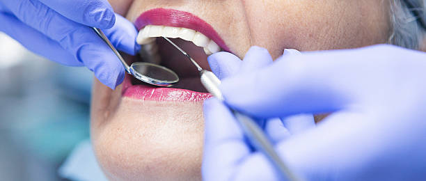 Best Emergency Tooth Extraction in Parkersburg, WV